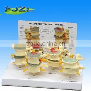 4-Stage Vertebrae Lifetime Flexible Human Spine,Medical Teaching Model Vertebral thumbnail-1