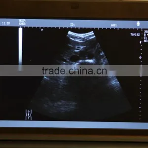 Clear Image Laptop Type Ultrasound Scanner System Full Digital Machine in Transport Carriage thumbnail-3