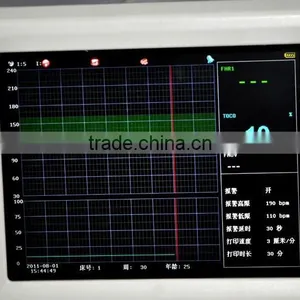 Good Price Fetal Monitor Fetal Heart Rate Monitoring Electronic Fetal Monitoring thumbnail-5