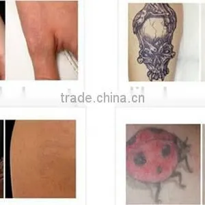 CE Approved 1064 & 532nm Tattoo Removal Active q Switch nd Yag Laser thumbnail-6
