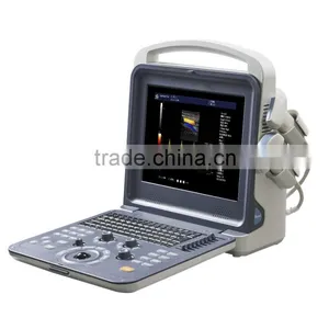 Digital Color Doppler 4D Ultrasound Machine K6 thumbnail-5