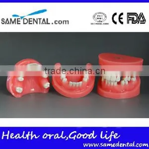Deletions Position Plugins Dental Models DEA-34 thumbnail-1