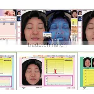 Sa100 Latest Excellent Magic Scoper Magic Mirror Skin Analysis thumbnail-2
