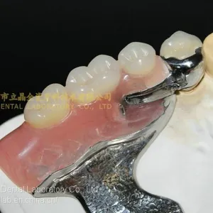 Dental Precision Attachment, Dental Attachment, Dental Denture, Laboratoire Dentaire, Dentallabor, Laboratorio Dental, Dental Laboratory, Shenzhen LJ Dental Lab China thumbnail-4