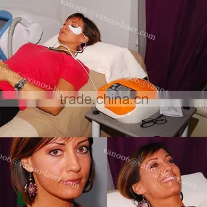 *2016 Portable RF Eye Care Machine/collagen Eye Gel/eye Slag/ Eye Bag/ Eye Skin Lifting/skin Tightening/home Use Machine thumbnail-4