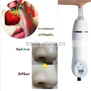 New Suction Pore Cleaning Crystal Microdermabrasion Crystal Peeling Machine thumbnail-3