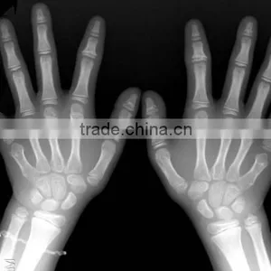 China Fuji X100 X-ray Film CE KND Film thumbnail-1