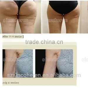 Ultrasonic Vacuum RF Kuma Body Slimming Body Contouring Machine thumbnail-5