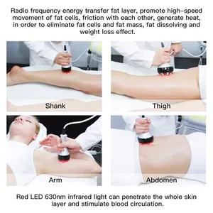 Industrial-Grade 6-in-1 Body Contouring Machine: 40K RF, EMS, Vacuum & Cavitation thumbnail-3
