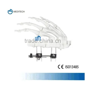 Orthofix Finger External Fixation Orthopedic Surgical Instruments Type C thumbnail-1