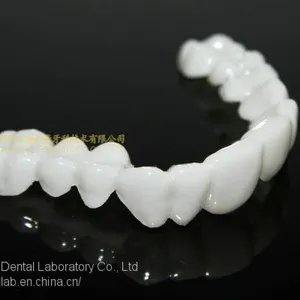 Dental PETG Clip on Veneers, Snap-on-veneers, Smile Veneers, Laboratoire Dentaire, Dentallabor, Laboratorio Dental, Dental Laboratory, Shenzhen LJ Dental Lab China thumbnail-1