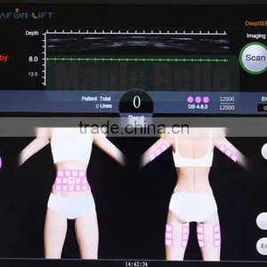 Reduce Cellulite Pigment Removal Skin Tightening Anti-wrinkle Machine!!! Portable HIFU Slimming Machine Portable Skin Tightening thumbnail-5