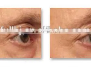 2015 New Arrival Monopolar RF Radio Frequency Tighten Wrinkle thumbnail-4