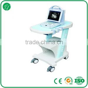 Hospital Equipment Laptop Ultrasound Machine/portable Ultrasound Scanner KX5600 thumbnail-4