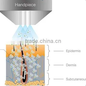 NL-HS201 2016 Portable Oxygen Facial Water Oxygen Spray Machine/derma Equipment/best Oxygen Facial Machine Oxygen Facial Equipment thumbnail-5