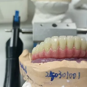CAM Milled Titanium Bar Dental Implant Hybrid Prosthesis Dentures Metal Implant Bar thumbnail-1