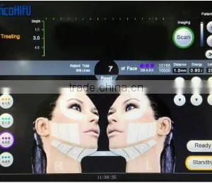 Skin Tightening Portable High Intensity Focused Portable High Frequency Face Machine Ultrasound HIFU Face Tightening Face Care Machine High Frequency Machine For Acne thumbnail-4
