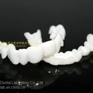 Dental PETG Clip on Veneers, Snap-on-veneers, Smile Veneers, Laboratoire Dentaire, Dentallabor, Laboratorio Dental, Dental Laboratory, Shenzhen LJ Dental Lab China thumbnail-2