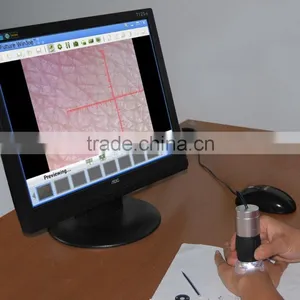 Easy Operation 1.3MP Handheld USB Digital Microscope for Skin Checking thumbnail-1