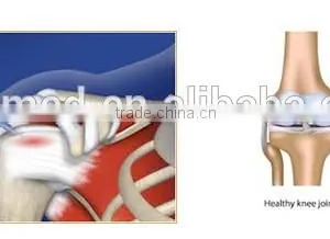 Platelet Rich Plasma PRP Tube thumbnail-6