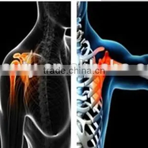 Shockwave Therapy System for Physiotherapy Medical Beauty Machine thumbnail-5