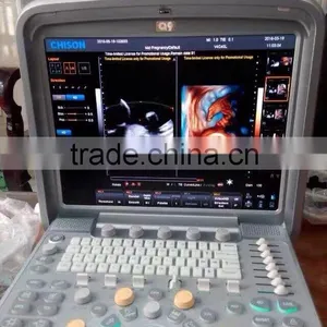 CE ISO Portable/laptop Color Doppler 3D/4D Ultrasound Diagnostic System Machine Clear Image thumbnail-2