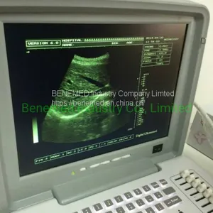 Portable B/W Ultrasound Scanner With Clear Image Quality Hospital Equipment thumbnail-2