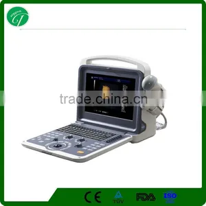 Digital Color Doppler 4D Ultrasound Machine K6 thumbnail-1