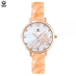 XINBOQIN Supplier Your LOGO Custom Ladies Brands Casual Quartz Waterproof Japan Movement PC21 Quartz Acetate Watch thumbnail-1