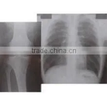 Dry Film X-ray Film Blue Medical Film China Film thumbnail-3
