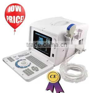CE Approved Laptop/Portable Ultrasound Scanner With 3.5Mhz Multi-frequency Convex Probe RUS-6000D thumbnail-1