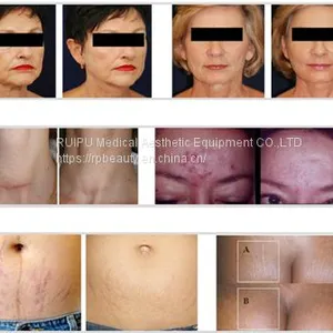 Personal Care PDT LED Skin Rejuvenation Device thumbnail-4