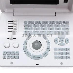 Factory Price!!CE Approved Notebook/Portable Ultrasound Scanner With 3.5Mhz Multi-frequency Convex Probe RUS-6000D thumbnail-2