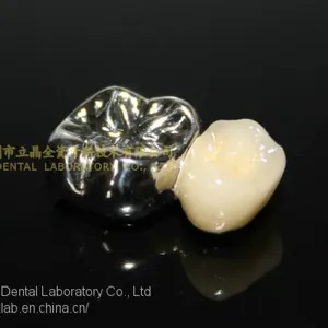 Full Metal Crown, FMC, FGC, Full Metal Post Core, Dental Crown, Cast Metal Crown, Dental Prosthesis, Laboratorio Dental, Dental Laboratory, Dentallabor, LJ Dental Lab China thumbnail-2