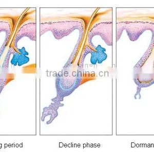 QTS Inner DCD Cooling 755nm Alexandrite Laser Hair Removal Equipment thumbnail-4