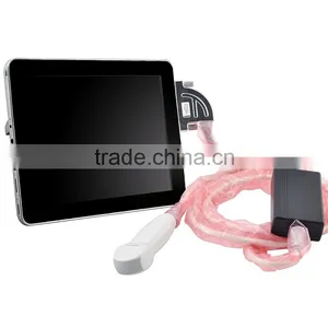 Manufacturer Wholesale pc Ipad Ultrasound Scanner China Good Price Mini Ultrasound Scan Machine thumbnail-3