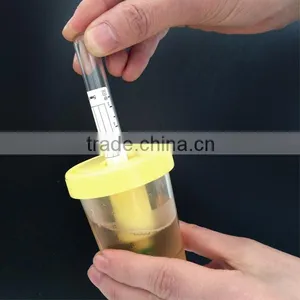Disposable Urine Specimen Container thumbnail-1