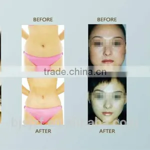 SL-2 Non-invasive Weight Loss Cool Fat Freezing Machine Cryo Slimming Machine thumbnail-5