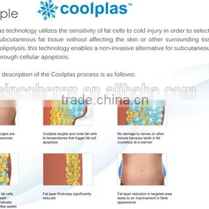 2015 Hot New Cryolipolysie Fat Freezing Slimming Weight Loss Machine With 3 Heads Best Cryolipolysie Fat Freezing Zeltiq thumbnail-5