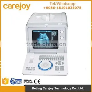 10 Inch Ultrasound Scanner Diagnostic System RUS 6000D With 3.5MHz Convex Probe Optional Sony Video Thermal Recorder thumbnail-1