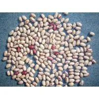 LIGHT SPECKLED KIDNEY BEANS AMERICA ROUND thumbnail-1
