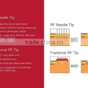 2015 Anti-aging Standing Micro-needle Fractional rf thumbnail-2