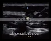 2016 NEW Ultrasound Scanner Color Doppler thumbnail-3