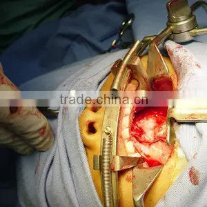 Dingman Retractor - Maxillofacial Instrument , Maxillary Instruments , Maxillo Surgery Instrument thumbnail-2