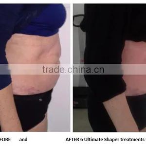 Back Tightening 2016 New Inventions Hifu Ultrasonic 4MHZ Liposuction Cavitation / Hifu Slimming Machine thumbnail-6