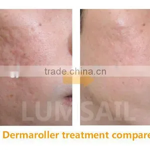 Professional 540 Needles Derma Roller Acne Scar Removal Dermaroller thumbnail-6