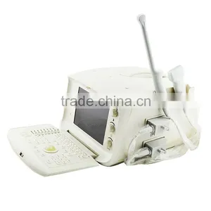 CE Approved One-stop Shopping Full Digital Ultrasound Scanner Price thumbnail-3