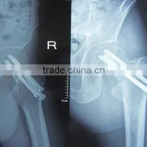China Radiografias Extraorales Film KND-A/F CE thumbnail-1
