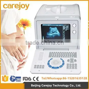 CE & FDA Approved Digital Portable Ultrasound Scanner Price thumbnail-1