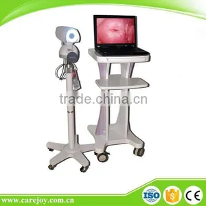 Portable Digital Electronic Colposcope RCS-500 for Cervical Erosion thumbnail-1